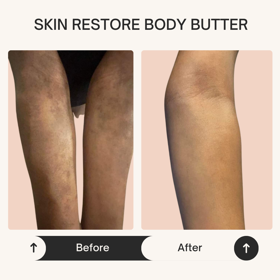 Skin Restore Butter